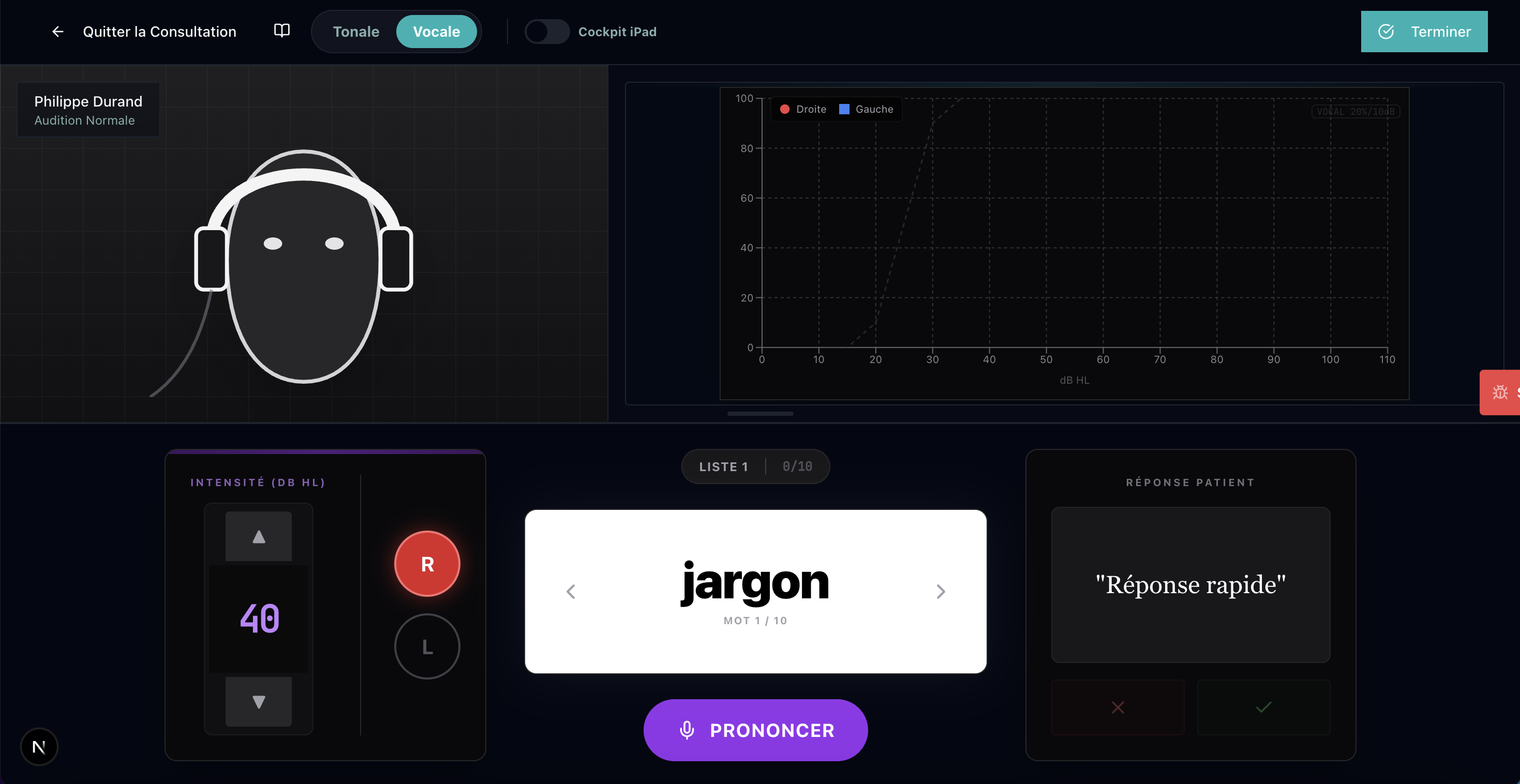 Simulation Audiométrie Vocale